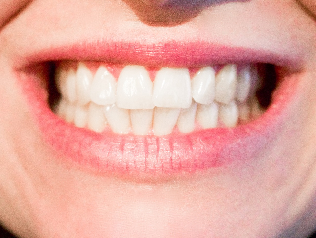 woman teeth photo